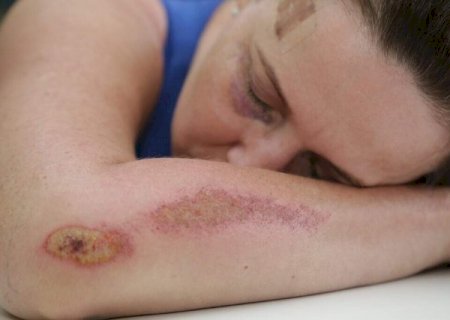 "Amor leve" vira tema de campanha para identificar rela&ccedil;&otilde;es abusivas
