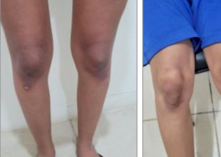 Mulheres são presas por torturar e manter em cárcere criança de  7 anos e adolescente em MS