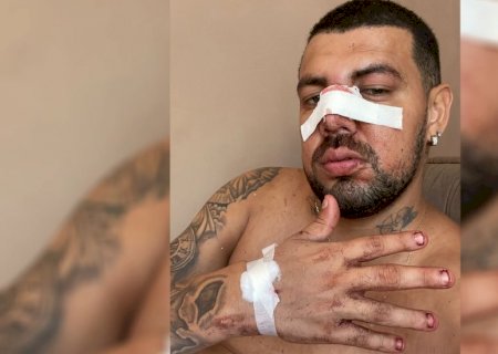 VÍDEO: Foliões denunciam violência policial na dispersão do Carnaval em Corumbá