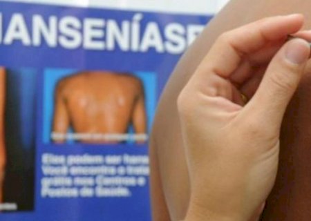 São Gabriel do Oeste firma convênio de R$ 2,2 milhões para tratamento de hanseníase
