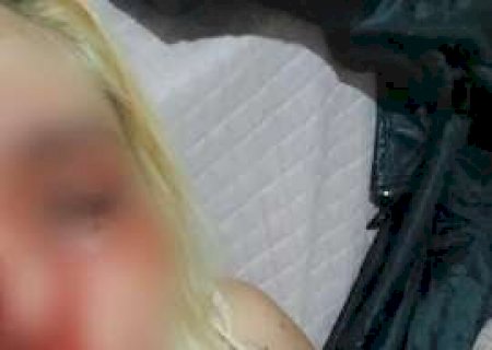 Com medo de morrer, jovem exp&otilde;e foto ensanguentada e denuncia ex por amea&ccedil;as