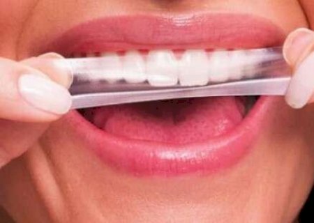 Anvisa manda recolher fitas de clareamento que viralizaram nas redes sociais