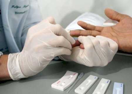 Um a cada 134 pessoas vivem com HIV/Aids em Campo Grande