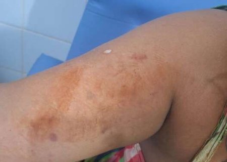 Ap&oacute;s 3 meses de relacionamento, homem espanca e tenta matar mulher a facadas
