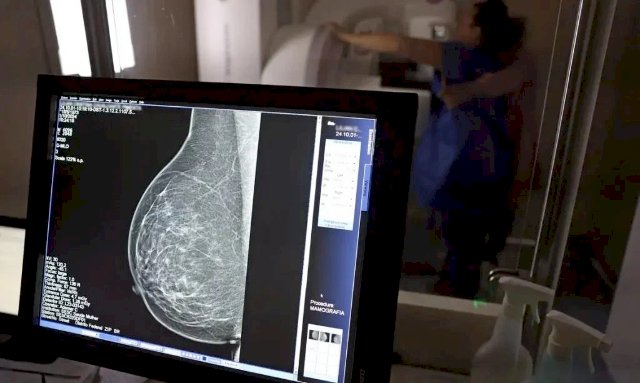 SUS incorpora teste gen&eacute;tico para c&acirc;ncer de mama que custa R$ 3 mil