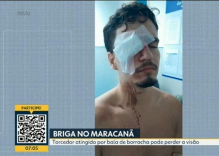 Jovem atingido por bala de borracha no Maracanã perde visão de um olho e fará cirurgia; mãe critica ação policial