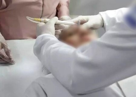 Conselho de Medicina libera uso de fenol mesmo ap&oacute;s proibi&ccedil;&atilde;o sanit&aacute;ria