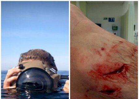 Fotógrafo desabafa sobre ataque de animal em Raglan: "Parece que fui esfaqueado umas seis vezes"
