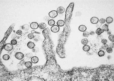 Infectologista da Capital detalha sintomas e preven&ccedil;&atilde;o &agrave; hantavirose