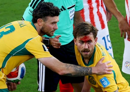 Jogador da Austrália sofre corte no rosto após disputa de bola em jogo com o Paraguai; veja imagens