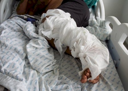 Espera por cirurgias cria "fila invis&iacute;vel" de pacientes na Santa Casa