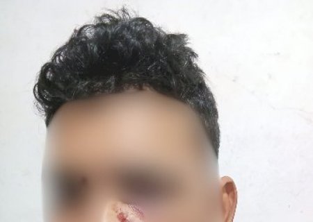 Horas ap&oacute;s crian&ccedil;a ferida, trabalhador acorda baleado no rosto dentro de casa