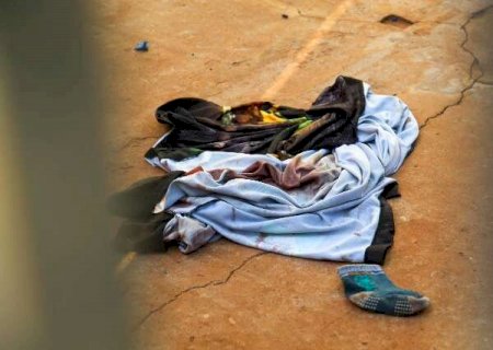 Ex-militar baleado na cabe&ccedil;a foi confundido com o irm&atilde;o em guerra de fac&ccedil;&otilde;es