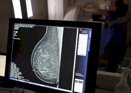 Tratamento oral contra c&acirc;ncer de mama avan&ccedil;ado &eacute; aprovado no Brasil