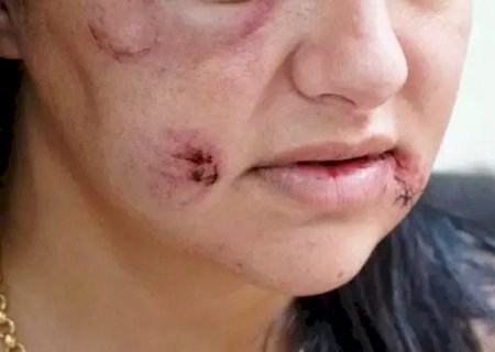 Feminic&iacute;dio vai entrar na lista internacional de doen&ccedil;as da OMS
