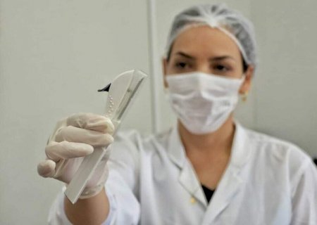 Implante contraceptivo usado no SUS passa a valer por cinco anos